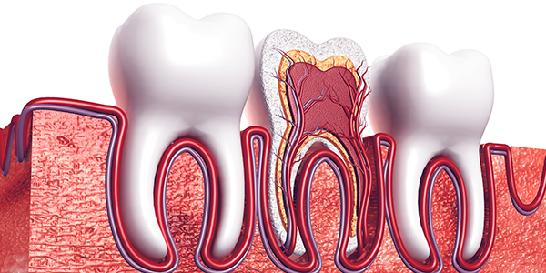 根管治療～重度のむし歯でも歯を残すために～